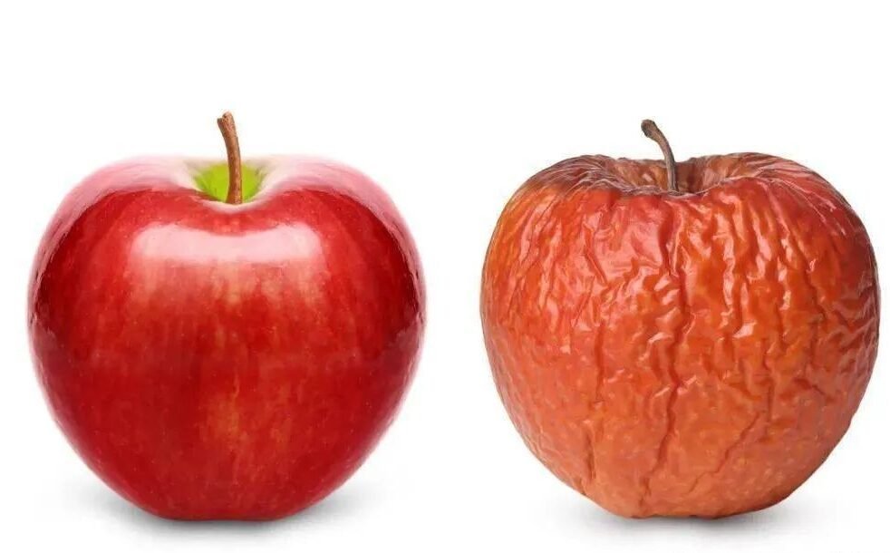 follicular dysplasia