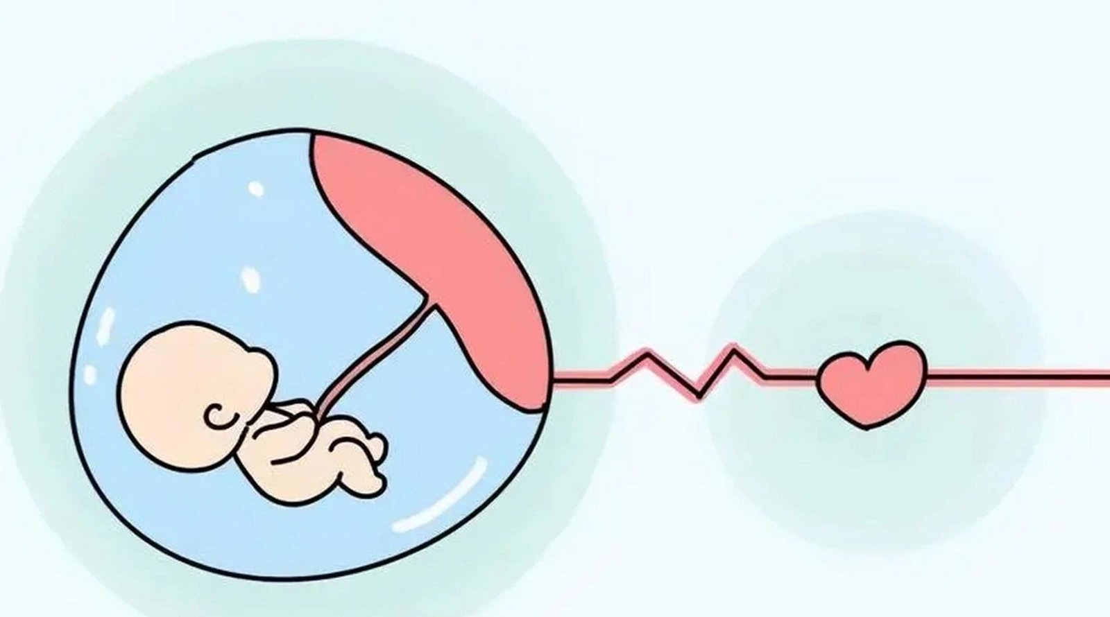 IVF Embryo Transfer
