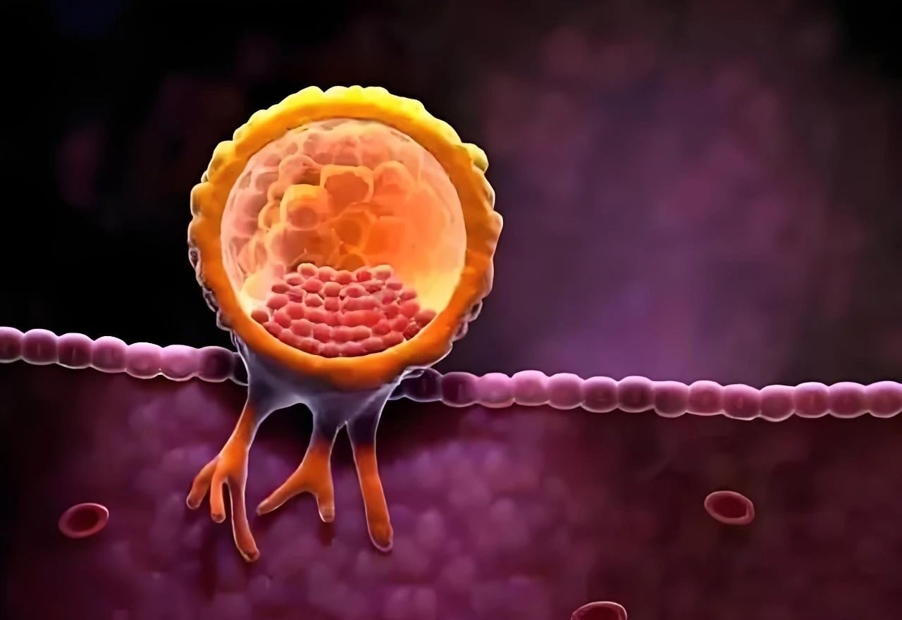IVF sac-feeding failure