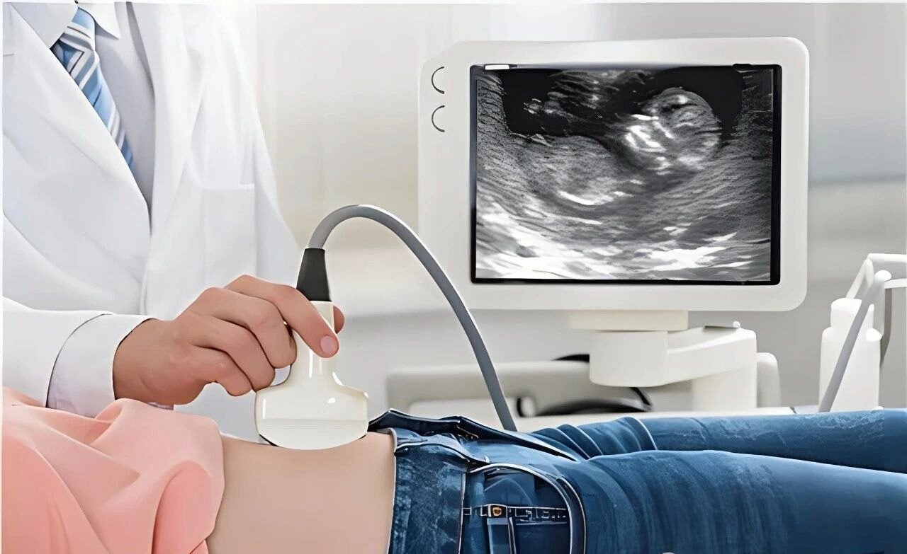 IVF Early Pregnancy Screening