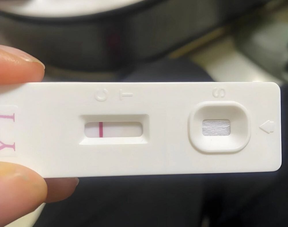 Follicular Dysplasia and Infertility